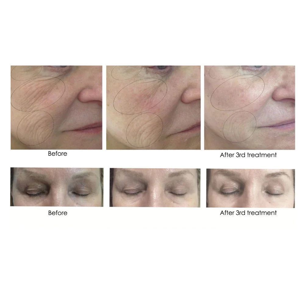 CO2Lift Pro Mask