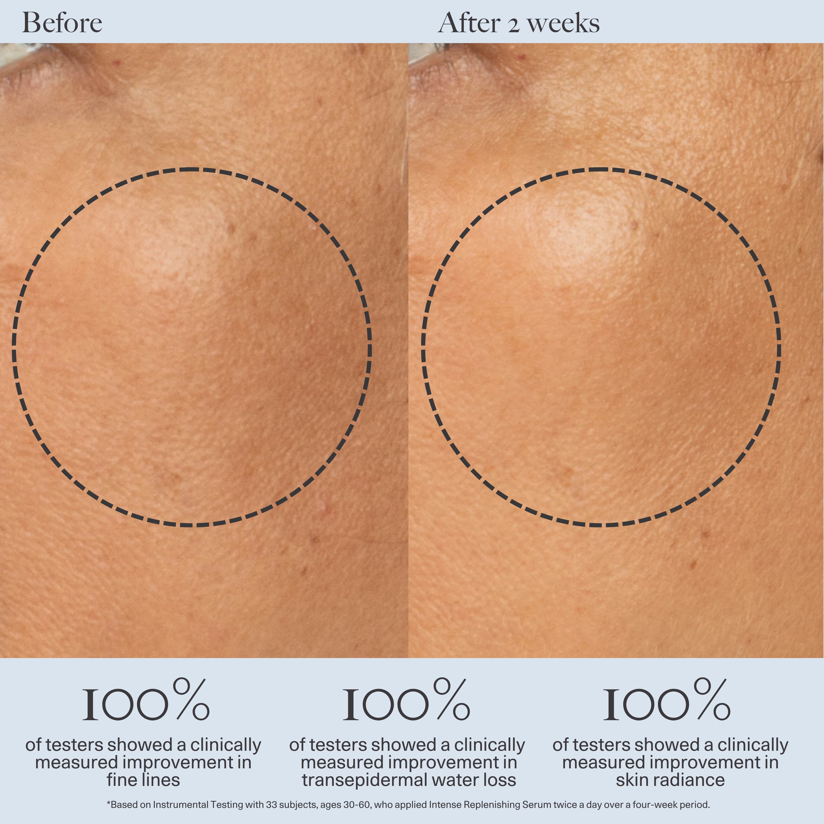Intense Replenishing Serum